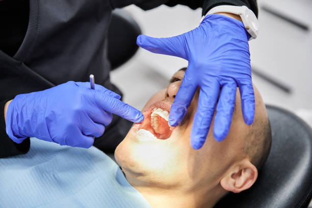 Best Emergency Dentist for Knocked-Out Tooth in Lake Grove, NY